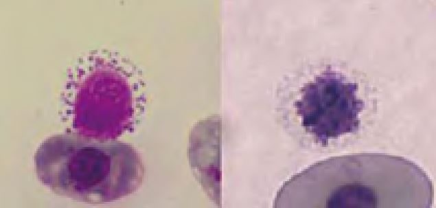 Laboklin: Basophils; the cell in the right image has no visible granules, the cytoplasm appears vacuolated