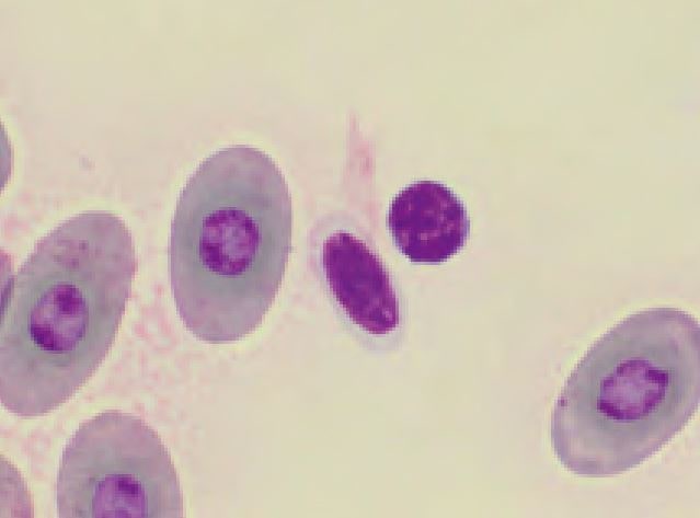 Laboklin: Erythrocytes, thrombocyte (centre) and lymphocyte (right)