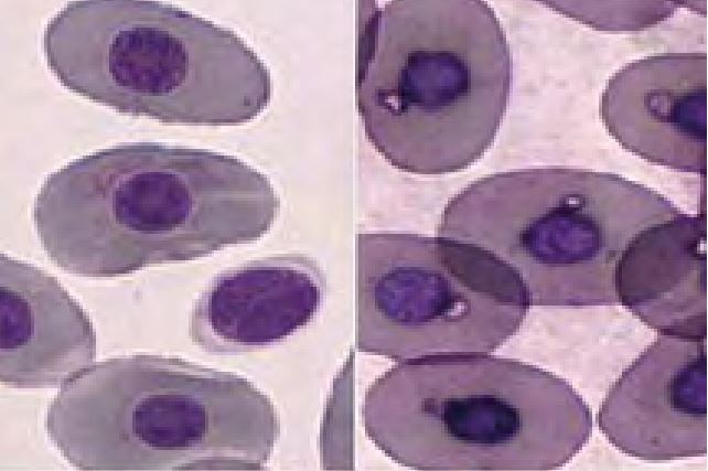 Laboklin: Left: normal erythrocytes and one thrombocyte, Right: erythrocytes displaying drying artefacts