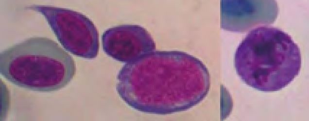 Laboklin: Dysplastic erythroid precursors (left) and one erythrocyte in mitosis (right) of a chameleon with massive inflammation caused by a foreign body in the cloaca