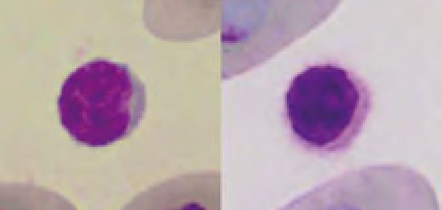 Laboklin: small lymphocyte; thrombocyte