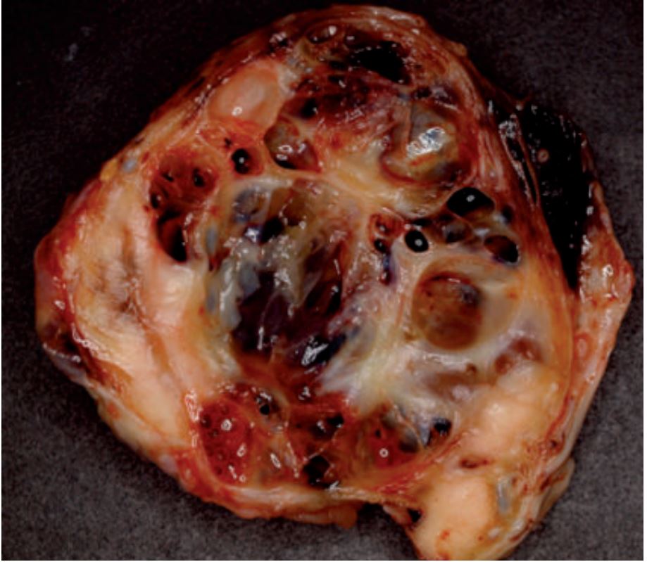 Laboklin: Granulosa cell tumour in a 9 year old mare