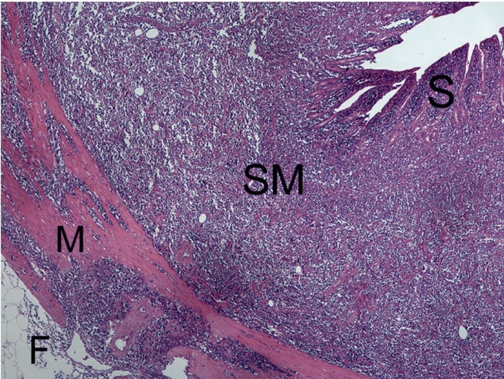 Laboklin: Intestinal lymphoma with transmural infiltration of tumor cells (S = mucosa, SM = submucosa, M = muscularis, F = fatty tissue)