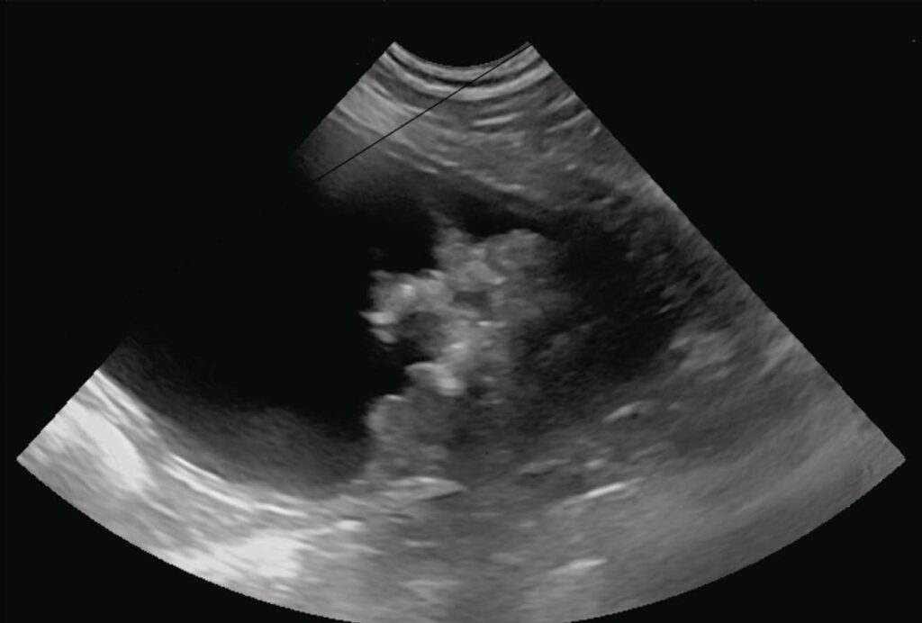 Laboklin: Sonographic image of the urinary bladder. A papillary mass clearly protrudes into the lumen of the bladder.