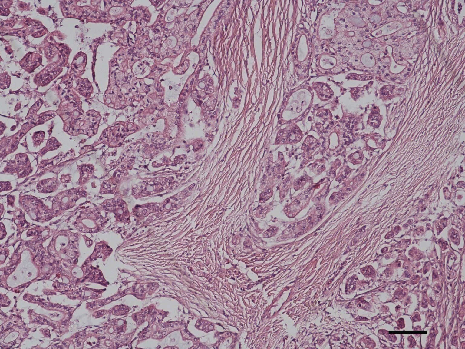 BRAF mutation in canine transitional cell and prostate carcinoma