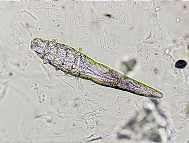 Laboklin: Dog follicle mite (Demodex canis); Demodex mites live in the hair follicles and feed on sebum as well as shed cellular material. They can be found in small numbers in many healthy animals (and also in humans).