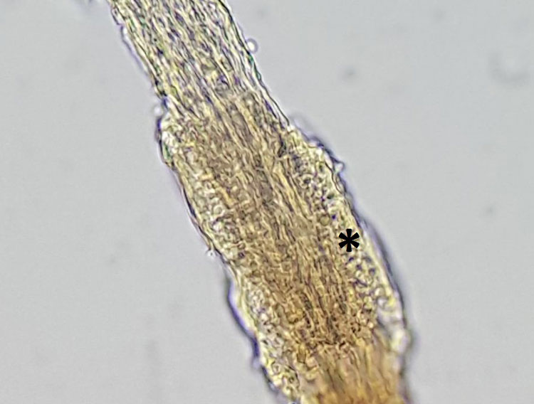 Laboklin: Dermathophytosis; the hair shaft is streaked with fungal hyphae; round fungal spores are visible at the edge (asterisk).