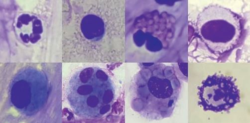 Laboklin: Inflammatory cells; above left to right: neutrophil, lymphocyte, eosinophil,  mast cell (Romanowsky rapid staining); below left to right: inactivated macropha ge, multinucleated macrophage, erythrophagocytosis, mast cell (toluidine blue).
