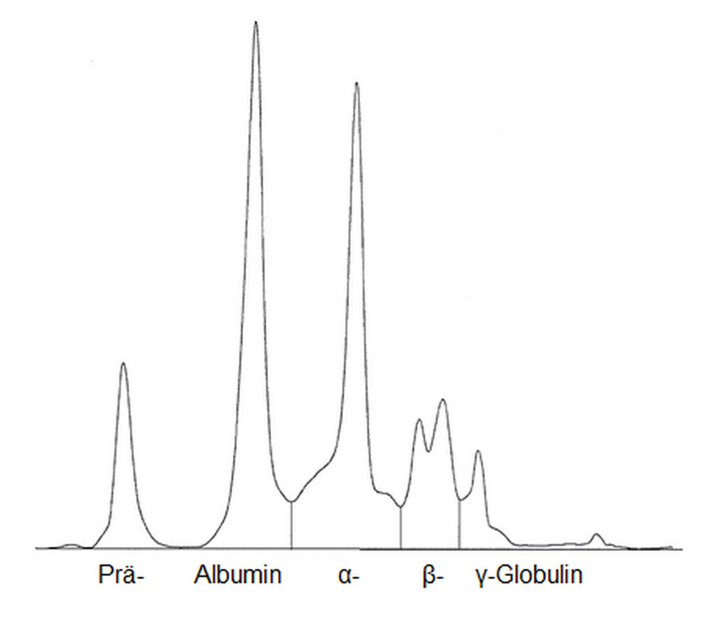 Laboklin: Analisi con elettroforesi capillare del plasma di una tartaruga di Hermann (Testudo hermanni) sana