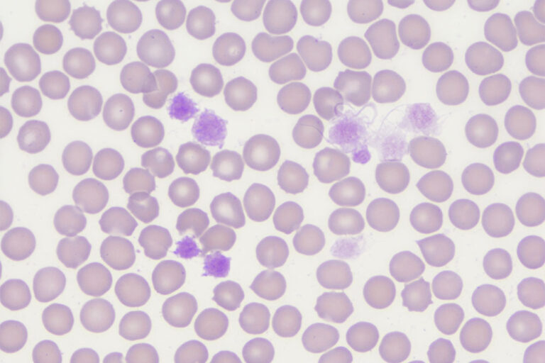 Laboklin: Macrothrombocytes, 1000x magnification, immersion oil, Giemsa stain