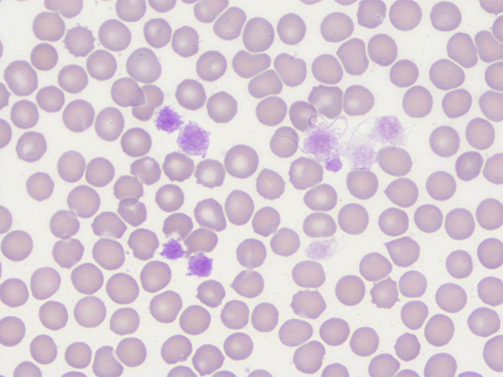 Laboklin: Macrothrombocytes, 1000x magnification, immersion oil, Giemsa stain