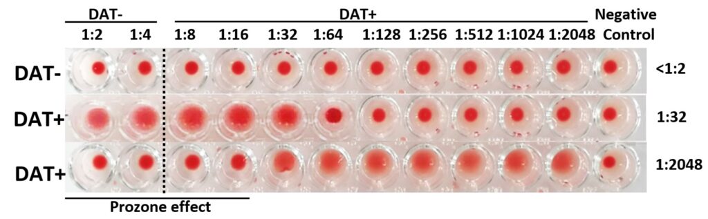 Laboklin: Coombs’ tests performed with the microtiter plate method. The titers are read from the left (low titers) to the right (high titers up to 1:2048). The last row only contains a mixture of NaCl and blood cells with no reagent and is used as negative auto-control. The titers below 1:8 are considered negative.The first line is a negative sample (DAT-), the second line is a positive sample with the titer 1:32 (DAT+), on the last line the titers 1:2 to 1:16 are negative (prozone effect), however this sample is strongly positive (1:2048).