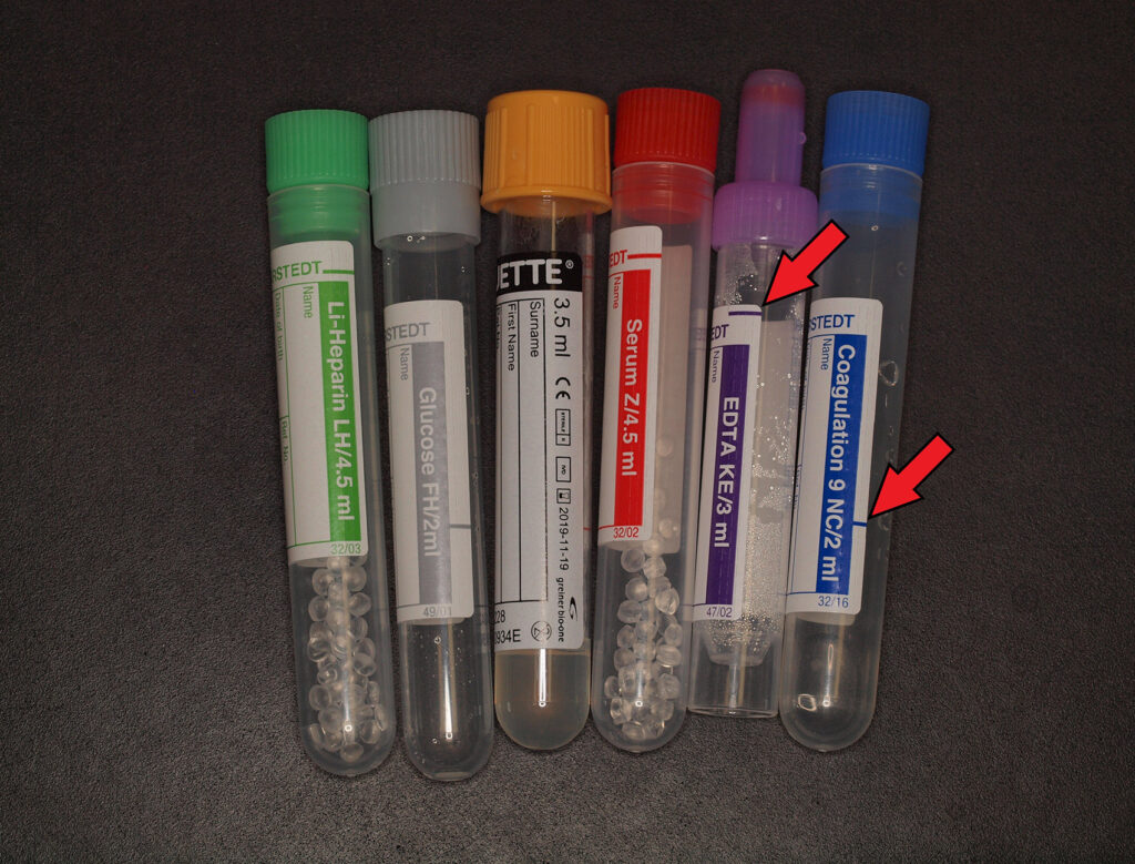 Laboklin: The ideal fill volume differs from one tube to another (see arrows on the two tubes on the right for the mark of the filling level which needs to be observed).