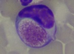 Laboklin: Foa-Kurloff cell with inclusion body of up to 8 µm size