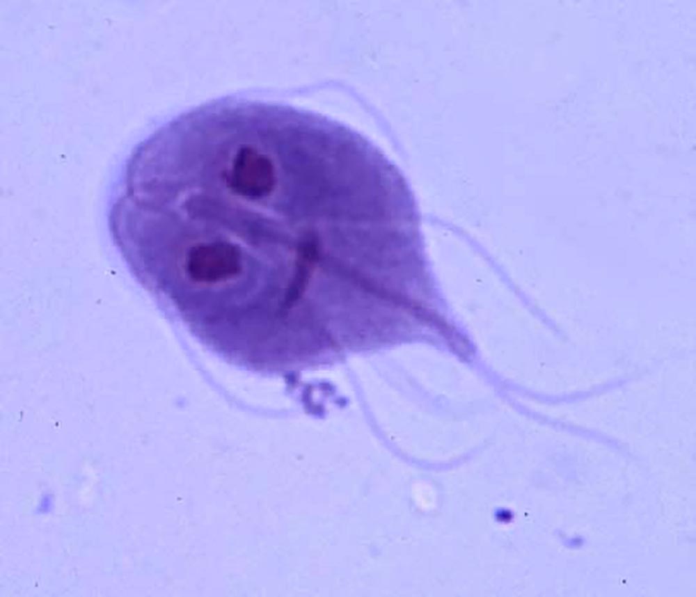 Laboklin: Close-up of Giardia spp.