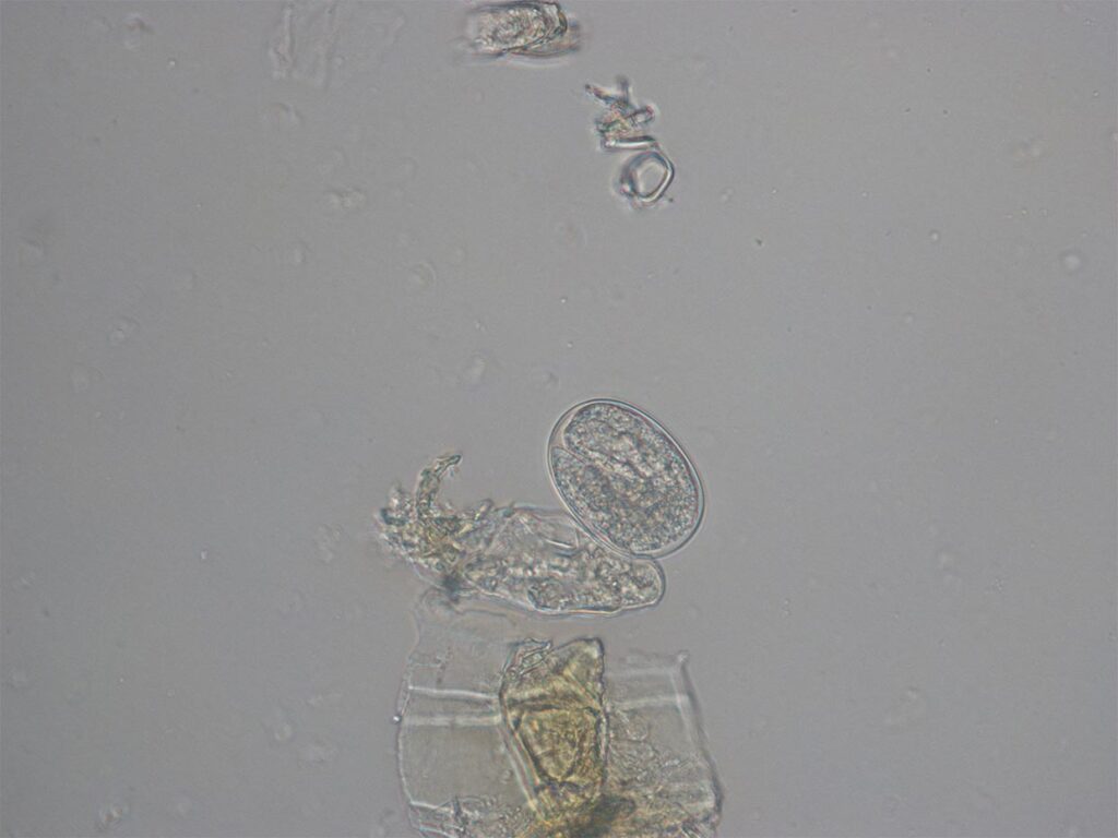 Laboklin: Strongyloides stercoralis: egg with larva
