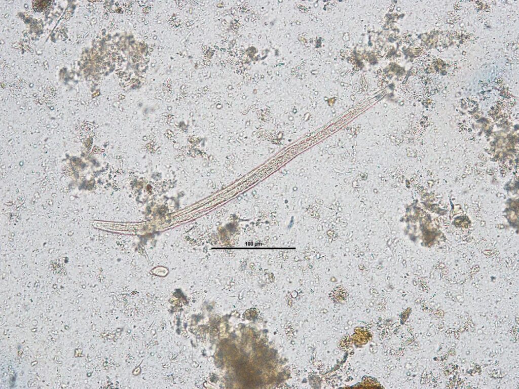 Laboklin: Strongyloides stercoralis: larva