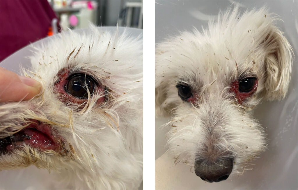 Mucocutaneous lupus erythematosus with ulcerative, crusty dermatitis on the lips and periocular region