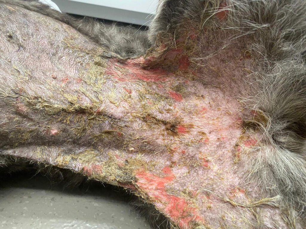 Vesicular variant of cutaneous lupus erythematosus presenting with multifocal, polycyclic erosions and partial crust formation