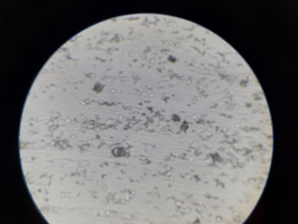 Immagine microscopica di cerume nell'orecchio di un coniglio. Il cerume assorbe a malapena il colorante (ingrandimento 100x, Diff-Quick®)