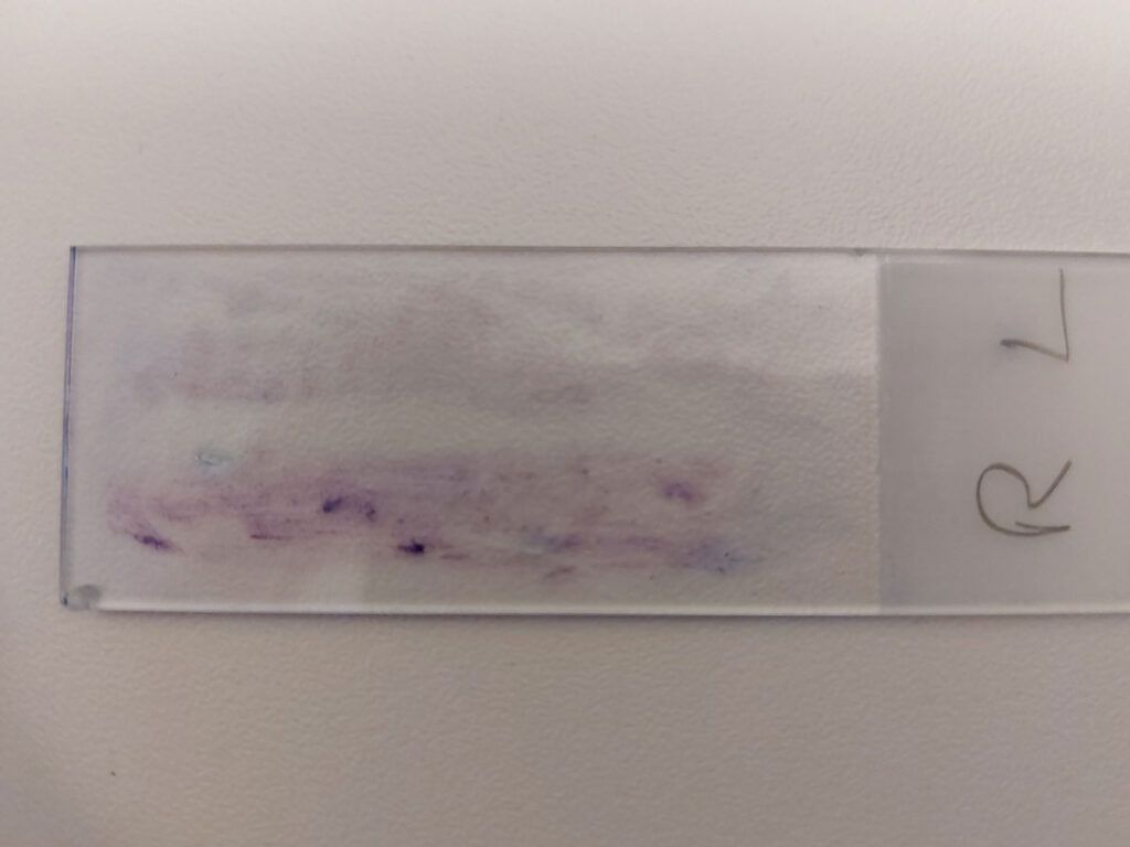 Vetrino colorato con Diff-Quick® con strisci da tamponi prelevati dalle orecchie destra (R) e sinistra (L) di un coniglio