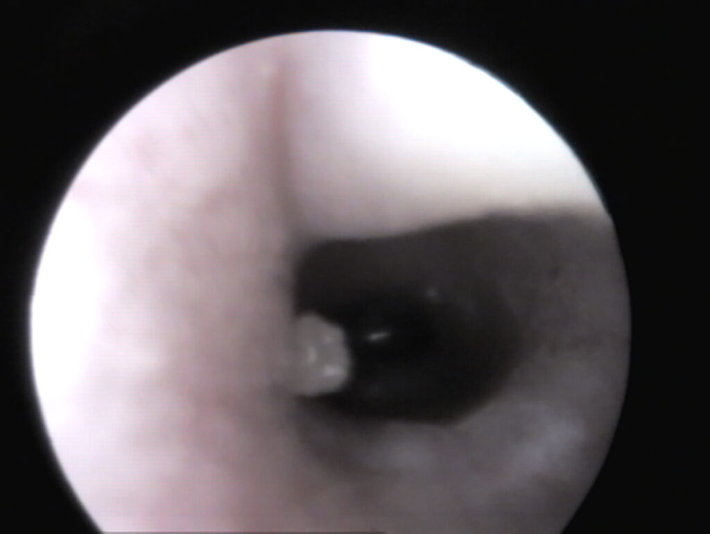 Vista del timpano (pars tensa - trasparente, pars flacida - tessuto) di un coniglio