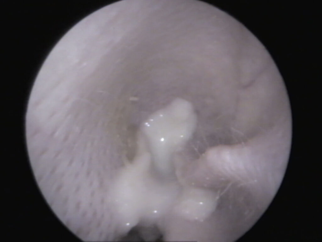 Vista dell'orecchio esterno pieno di pus di un coniglio – l'orecchio esterno senza alterazioni suggerisce che il pus provenga dall'orecchio medio