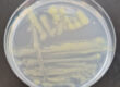 Flavobacterium columnare colonies on Anacker–Ordal agar