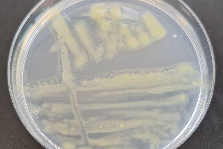 Flavobacterium columnare colonies on Anacker–Ordal agar