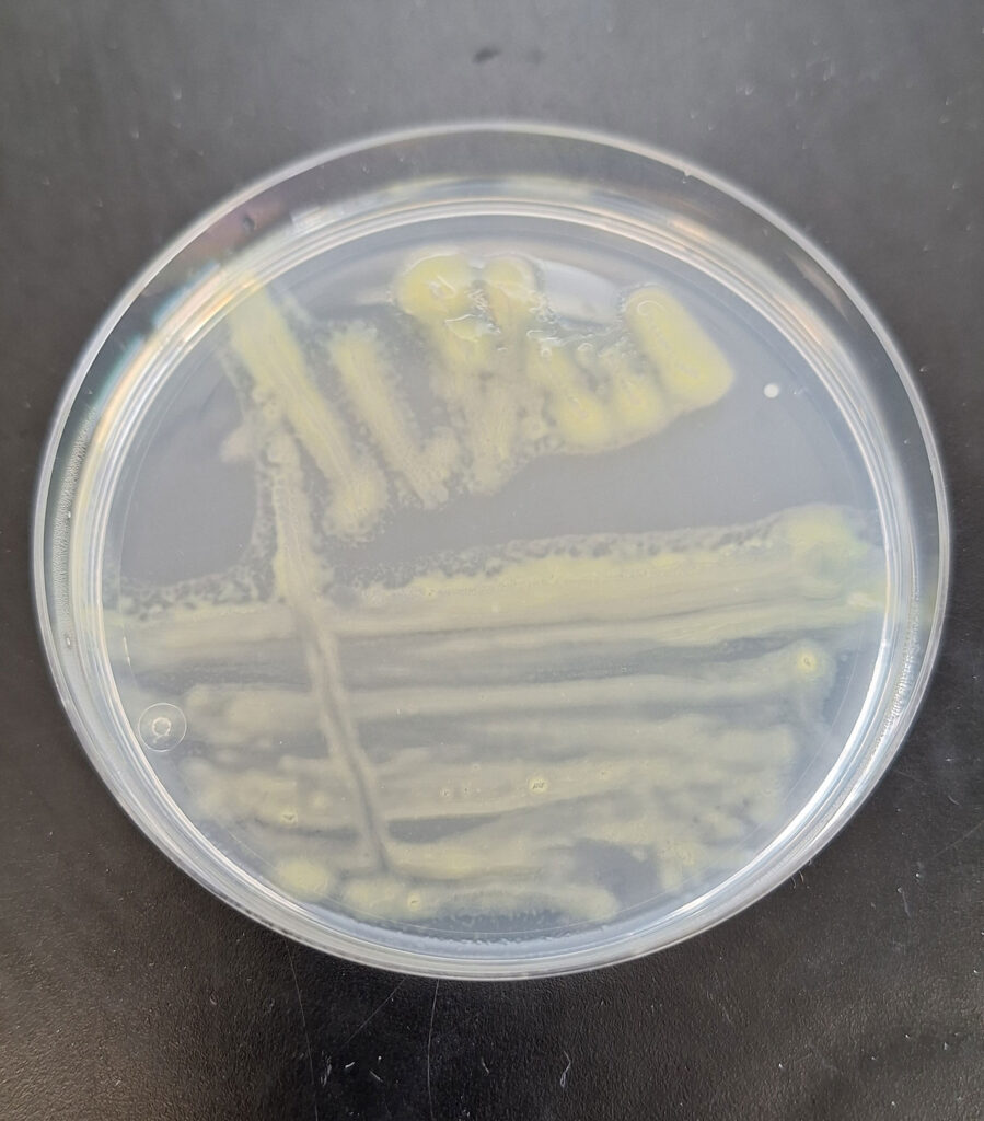 Flavobacterium columnare colonies on Anacker–Ordal agar