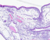 Histology of a nasal polyp in a dog, 4× magnification, H&E stain