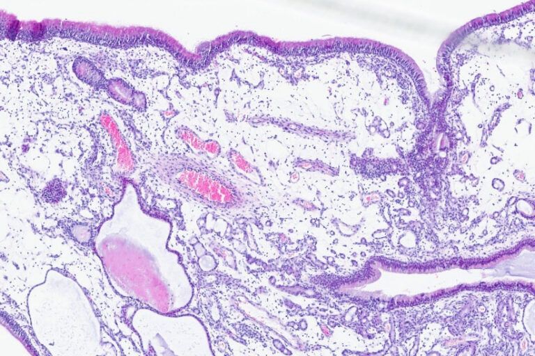Histology of a nasal polyp in a dog, 4× magnification, H&E stain