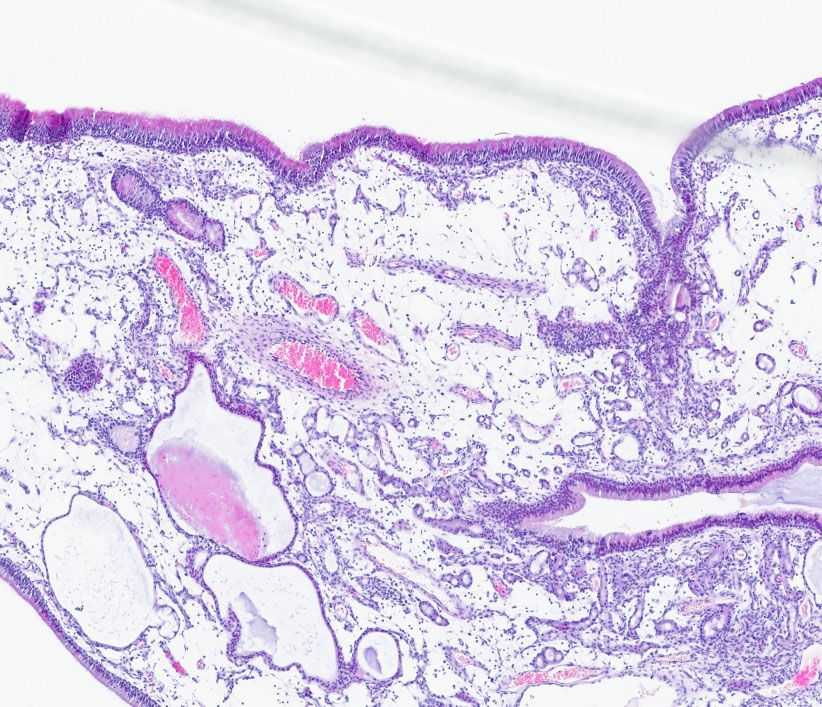 Histology of a nasal polyp in a dog, 4× magnification, H&E stain