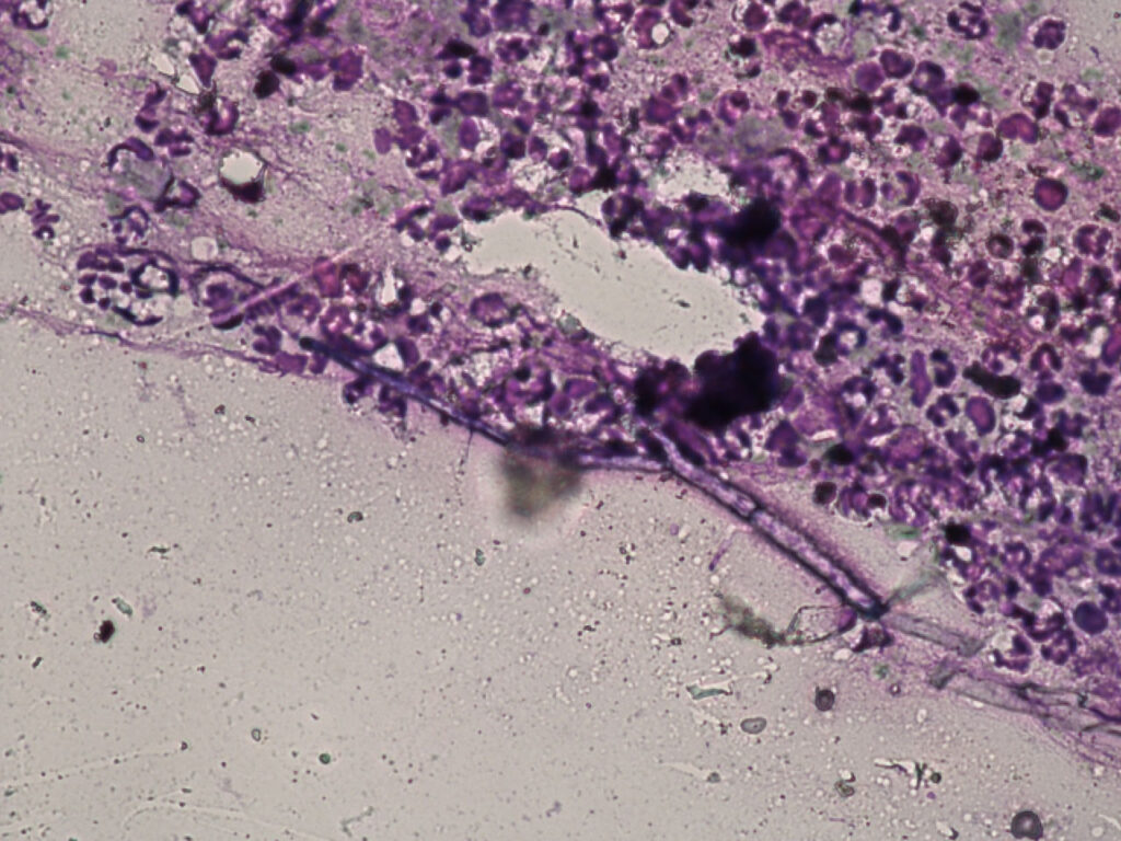 Cytology of a nasal swab from a dog showing fungal hyphae, 40× magnification